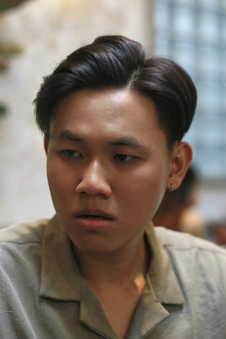 頭皮護理案例－髮線問題示意圖