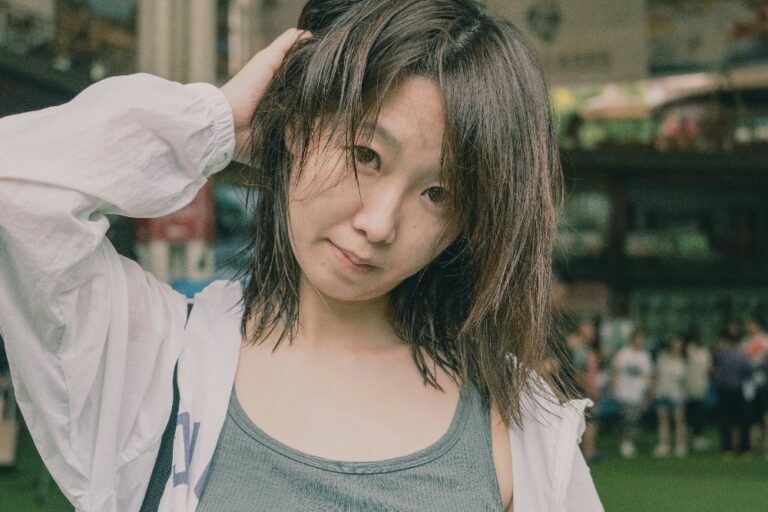 頭皮護理案例－髮線問題示意圖